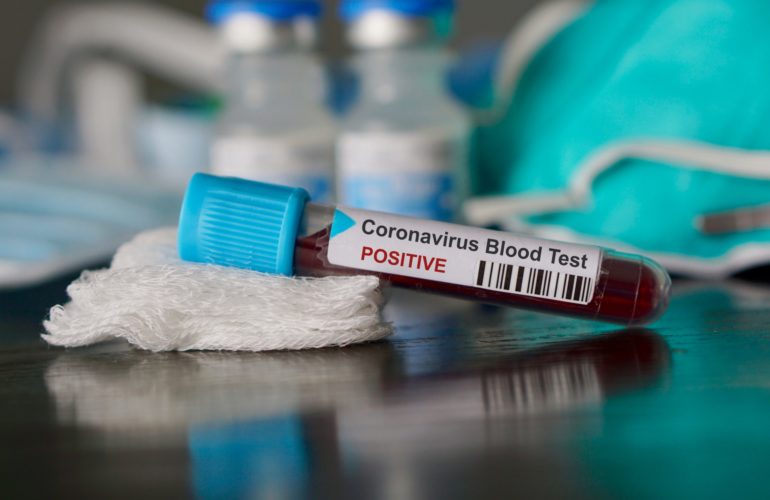 coronavirus morti