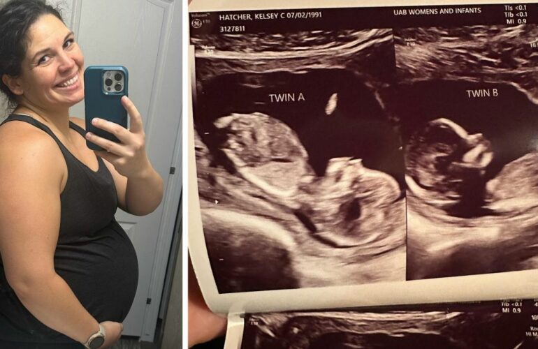 donna-con-due-uteri-resta-incinta-in-entrambi-contemporaneamente